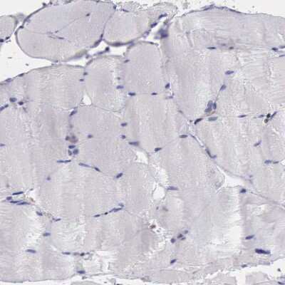 Immunohistochemistry-Paraffin: PD-ECGF/Thymidine Phosphorylase Antibody [NBP1-84916]