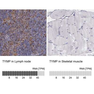 Immunohistochemistry-Paraffin: PD-ECGF/Thymidine Phosphorylase Antibody [NBP1-84916]