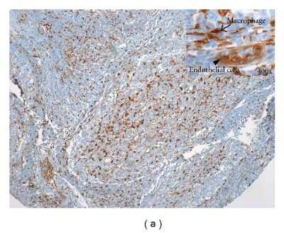 Immunohistochemistry: PD-ECGF/Thymidine Phosphorylase Antibody (PGF 44C) - BSA Free [NB100-2737]