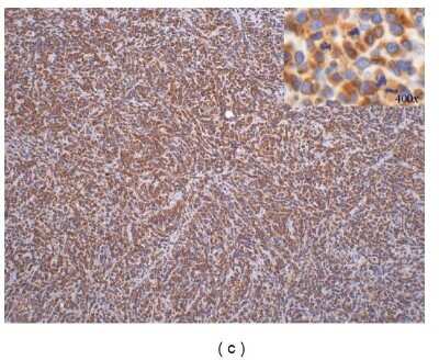 Immunohistochemistry: PD-ECGF/Thymidine Phosphorylase Antibody (PGF 44C) - BSA Free [NB100-2737]