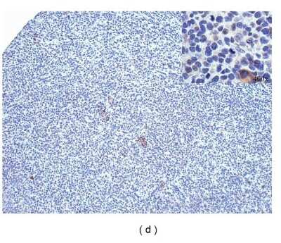 Immunohistochemistry: PD-ECGF/Thymidine Phosphorylase Antibody (PGF 44C) - BSA Free [NB100-2737]