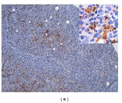 Immunohistochemistry: PD-ECGF/Thymidine Phosphorylase Antibody (PGF 44C) - BSA Free [NB100-2737]