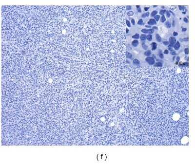 Immunohistochemistry: PD-ECGF/Thymidine Phosphorylase Antibody (PGF 44C) - BSA Free [NB100-2737]
