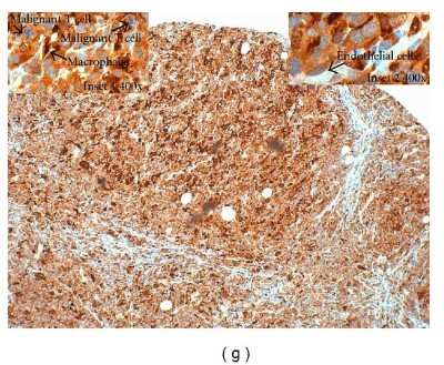 Immunohistochemistry: PD-ECGF/Thymidine Phosphorylase Antibody (PGF 44C) - BSA Free [NB100-2737]