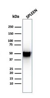 Western Blot: PD-ECGF/Thymidine Phosphorylase Antibody (SPM322)Azide and BSA Free [NBP2-54403]