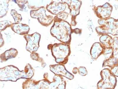 Immunohistochemistry-Paraffin: PD-ECGF/Thymidine Phosphorylase Antibody (SPM322) [NBP2-53396]