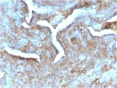Immunohistochemistry-Paraffin: PD-ECGF/Thymidine Phosphorylase Antibody (TYMP/2890R) - Azide and BSA Free [NBP3-08402]