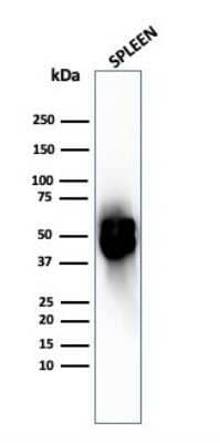 Western Blot: PD-ECGF/Thymidine Phosphorylase Antibody (TYMP/2890R)Azide and BSA Free [NBP3-08402]