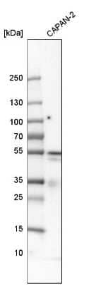 Western Blot: PD-ECGF/Thymidine Phosphorylase Antibody [NBP1-84916]