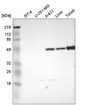 Western Blot: PD-ECGF/Thymidine Phosphorylase Antibody [NBP2-55129]