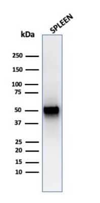 Western Blot: PD-ECGF/Thymidine Phosphorylase Antibody (rTYMP/3444)Azide and BSA Free [NBP3-08359]