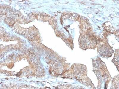 Immunohistochemistry-Paraffin: PD-ECGF/Thymidine Phosphorylase Antibody (rTYMP/3444) [NBP3-07270]