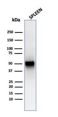 Western Blot: PD-ECGF/Thymidine Phosphorylase Antibody (rTYMP/3444) [NBP3-07270]