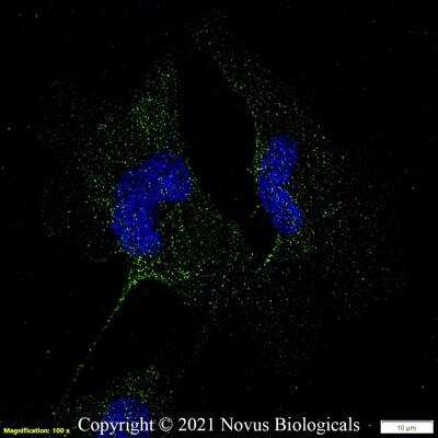 Immunocytochemistry/ Immunofluorescence: PD-L1 Antibody - BSA Free [NBP1-76769]