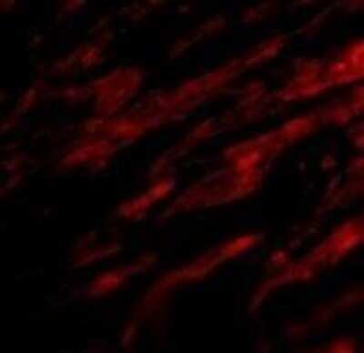 Immunofluorescence: PD-L1 Antibody - BSA Free [NBP1-76769]