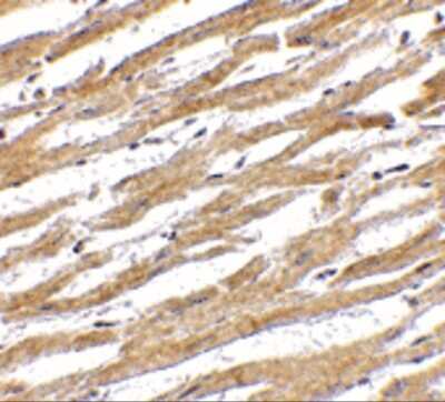 Immunohistochemistry-Paraffin: PD-L1 Antibody - BSA Free [NBP1-76769]