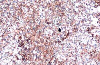 Immunohistochemistry-Paraffin: PD-L1 Antibody [NBP2-15791]