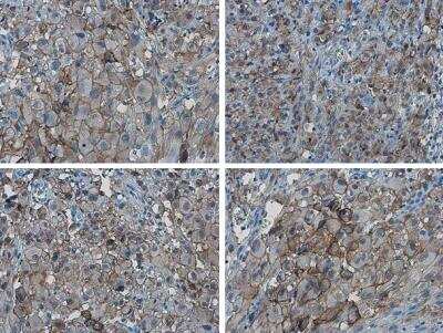 Immunohistochemistry-Paraffin: PD-L1 Antibody [NBP2-15791]