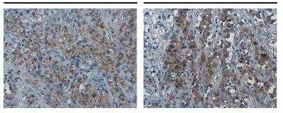 Immunohistochemistry-Paraffin: PD-L1 Antibody [NBP2-15791]