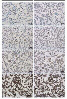 Immunohistochemistry-Paraffin: PD-L1 Antibody [NBP2-15791]