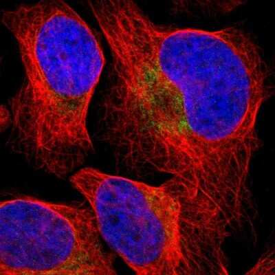 Immunocytochemistry/ Immunofluorescence: PD-L2/B7-DC/PDCD1LG2 Antibody [NBP1-88964]