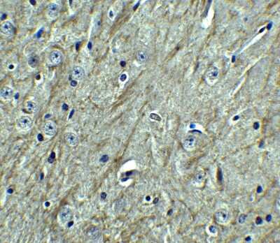 Immunohistochemistry: PD-L2/B7-DC/PDCD1LG2 Antibody - BSA Free [NBP1-76770]