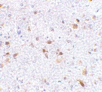 Immunohistochemistry-Paraffin: PD-L2/B7-DC/PDCD1LG2 Antibody - BSA Free [NBP1-76770]