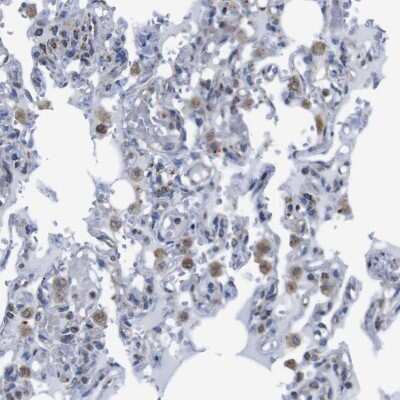 Immunohistochemistry-Paraffin: PD-L2/B7-DC/PDCD1LG2 Antibody [NBP1-88964]