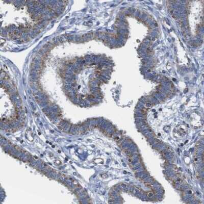 Immunohistochemistry-Paraffin: PD-L2/B7-DC/PDCD1LG2 Antibody [NBP1-88964]