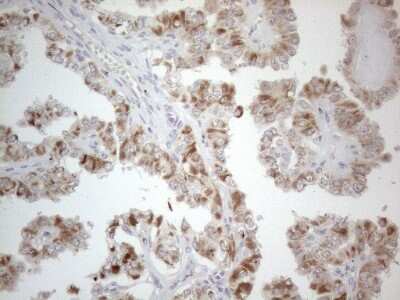 Immunohistochemistry: PD-L2/B7-DC/PDCD1LG2 Antibody (OTI7B10) [NBP2-46347]