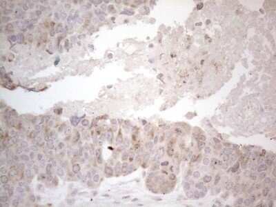 Immunohistochemistry: PD-L2/B7-DC/PDCD1LG2 Antibody (OTI7B10) [NBP2-46347]