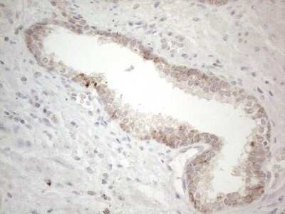 Immunohistochemistry: PD-L2/B7-DC/PDCD1LG2 Antibody (OTI7B10) [NBP2-46347]