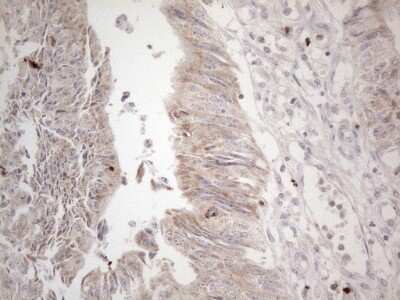 Immunohistochemistry: PD-L2/B7-DC/PDCD1LG2 Antibody (OTI7B10) [NBP2-46347]