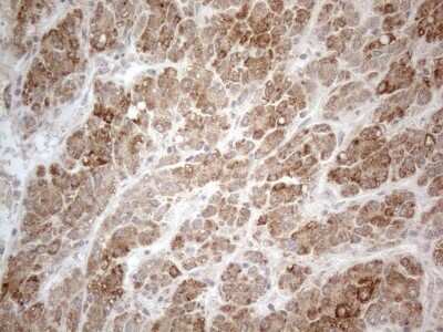 Immunohistochemistry: PD-L2/B7-DC/PDCD1LG2 Antibody (OTI7B10) [NBP2-46347]