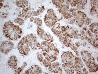 Immunohistochemistry: PD-L2/B7-DC/PDCD1LG2 Antibody (OTI7B10) [NBP2-46347]