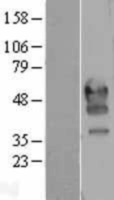 Western Blot: PD-1 Overexpression Lysate [NBP2-04279]