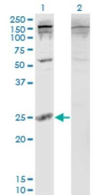 Western Blot: PDAP1 Antibody (3B10) [H00011333-M05]