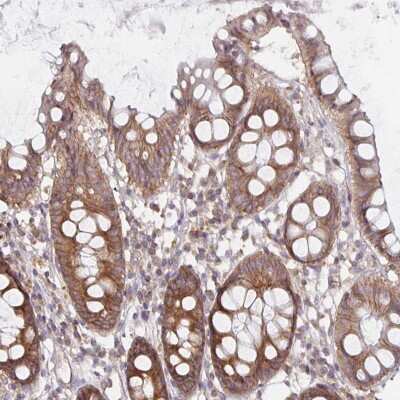 Immunohistochemistry: PDAP1 Antibody [NBP2-38899]