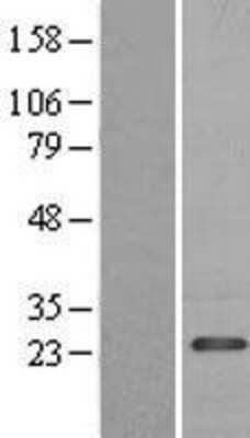 Western Blot: PDAP1 Overexpression Lysate [NBL1-14201]