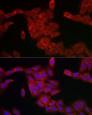 Immunocytochemistry/ Immunofluorescence: PDCD10 Antibody - Azide and BSA Free [NBP2-93073]