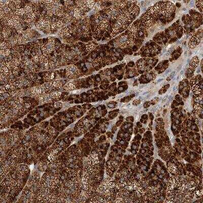 Immunohistochemistry: PDCD10 Antibody [NBP1-86574]