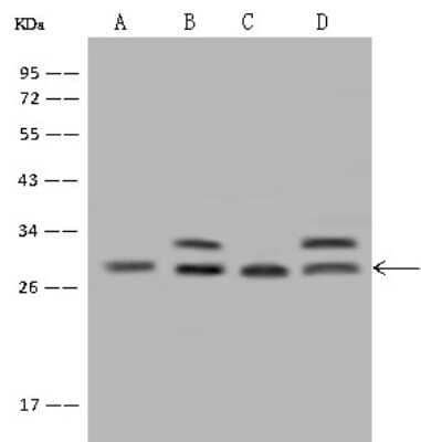 Western Blot: PDCD10 Antibody [NBP2-97685]