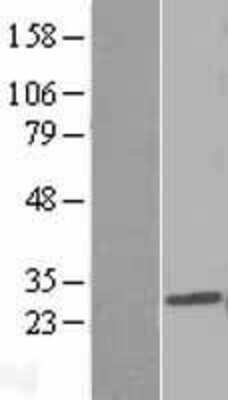 Western Blot: PDCD10 Overexpression Lysate [NBP2-09985]