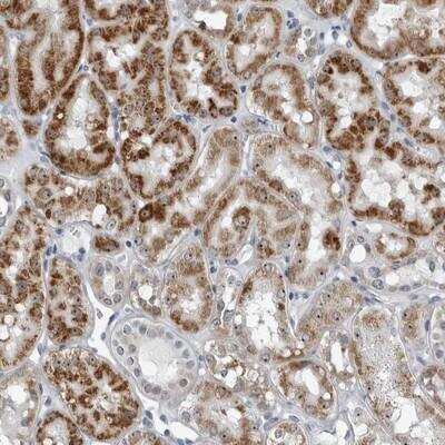 Immunohistochemistry: PDCD11 Antibody [NBP1-89141]