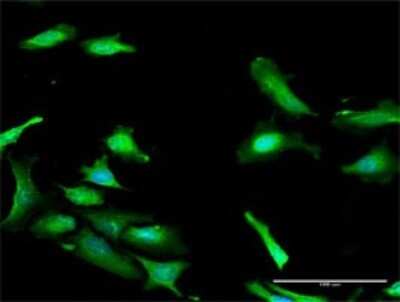 Immunocytochemistry/ Immunofluorescence: PDCD2 Antibody [H00005134-D01P]