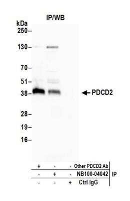 Immunoprecipitation: PDCD2 Antibody [NBP2-04042]