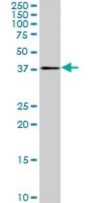 Western Blot: PDCD2L Antibody (5F9) [H00084306-M01]