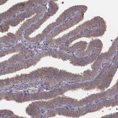 Immunohistochemistry-Paraffin: PDCD2L Antibody [NBP2-58526]