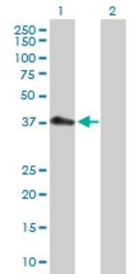 Western Blot: PDCD2L Antibody [H00084306-D01P]