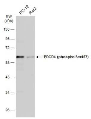 Western Blot: PDCD4 [p Ser457] Antibody [NBP3-13143]